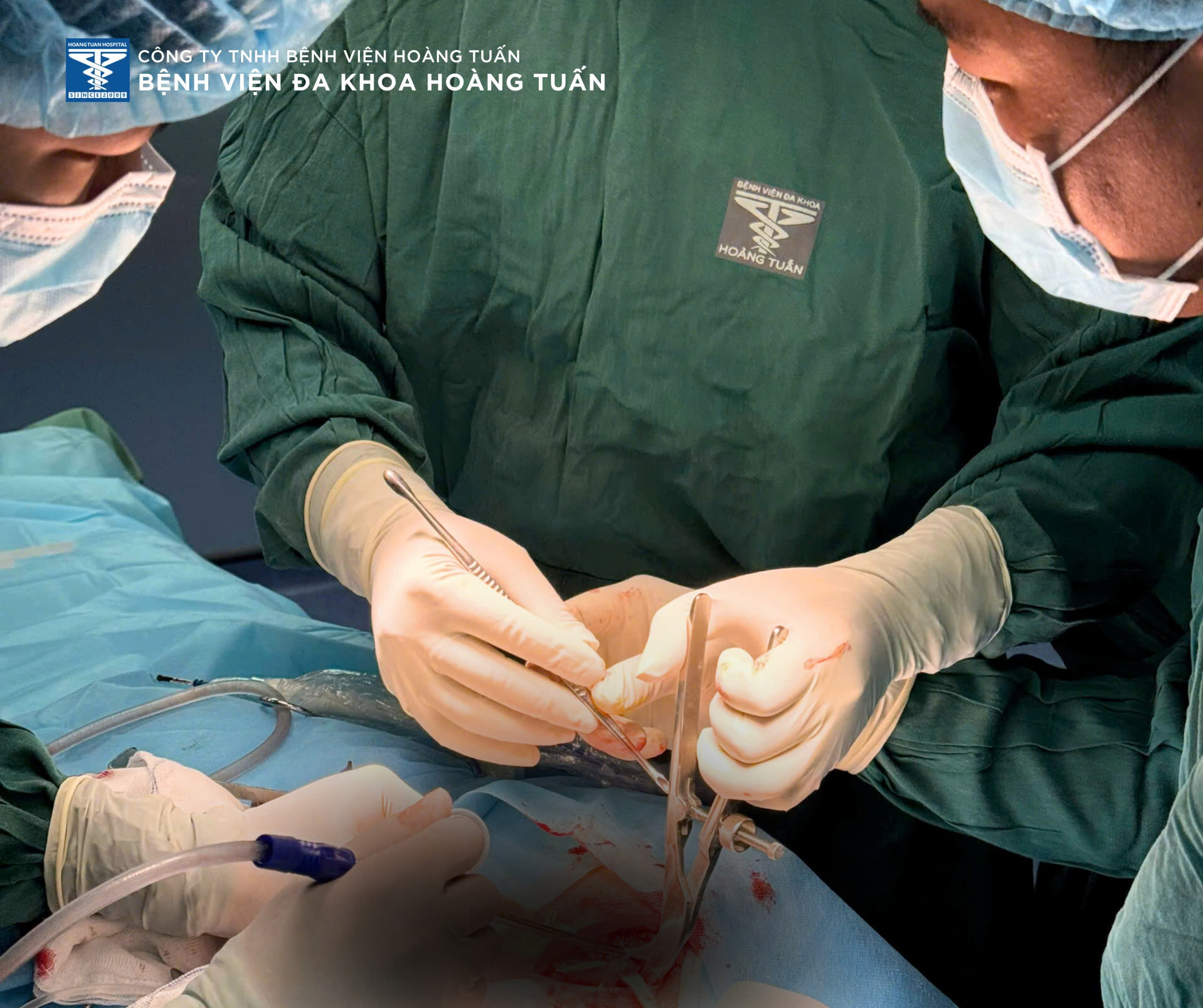 Phẫu thuật kết hợp xương đòn