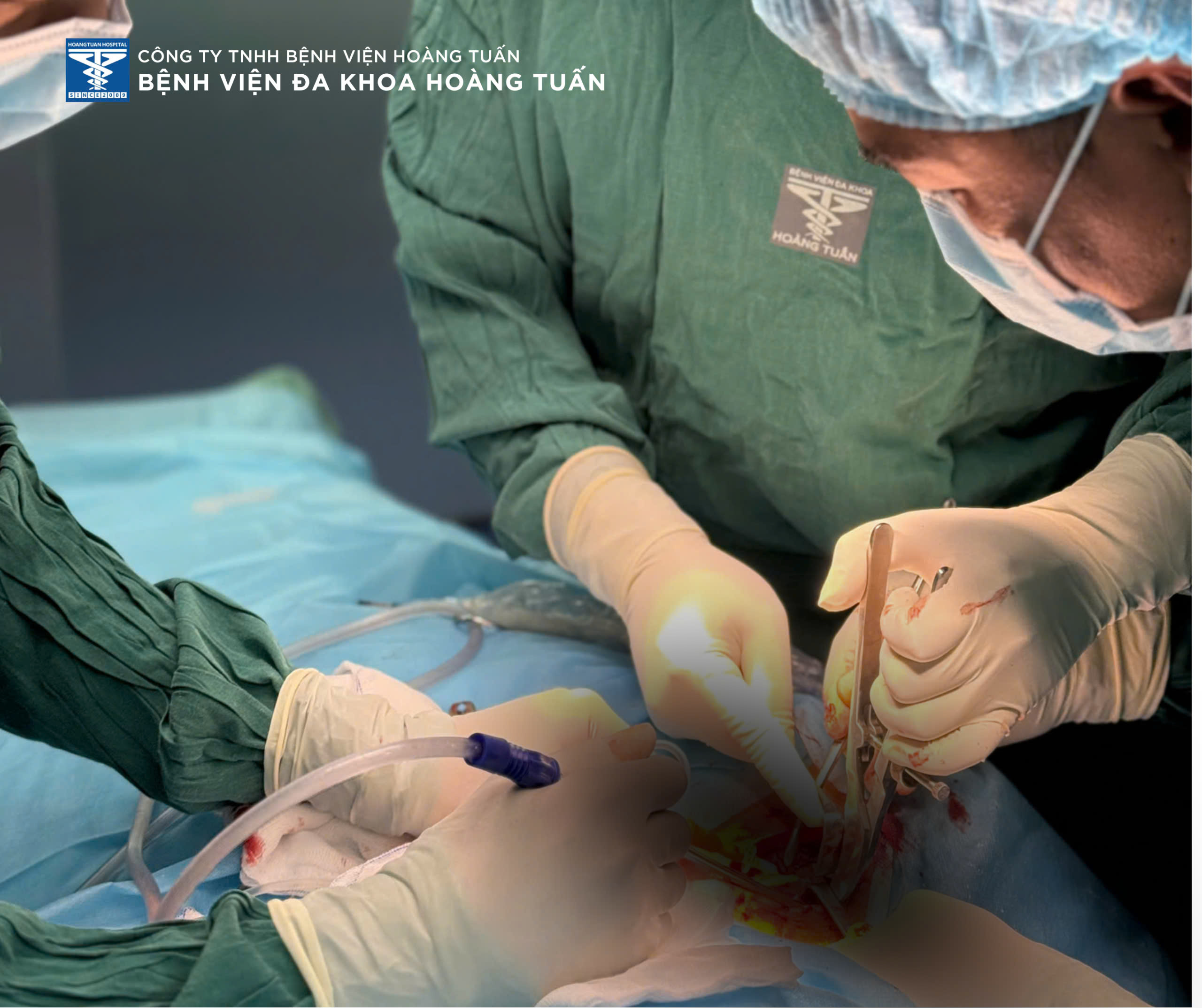 Phẫu thuật kết hợp xương đòn